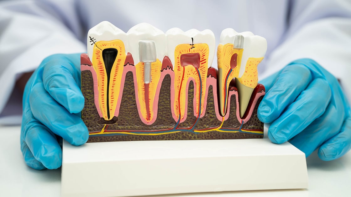 Endo Services Image
