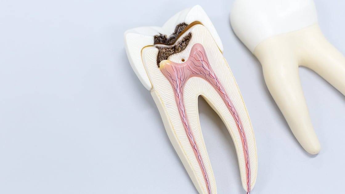 Retreatment Image